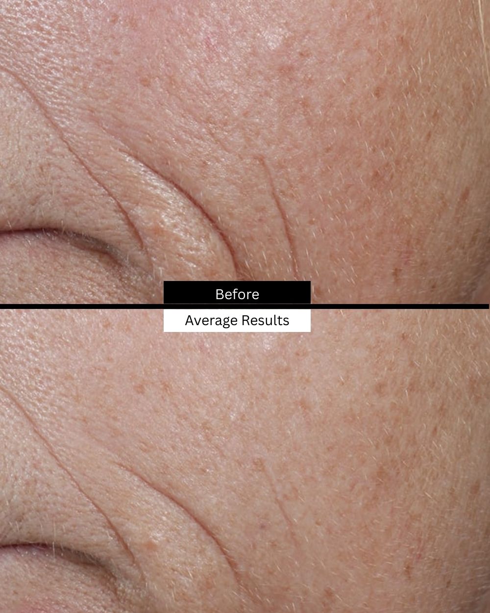 C E Ferulic Skinceuticals