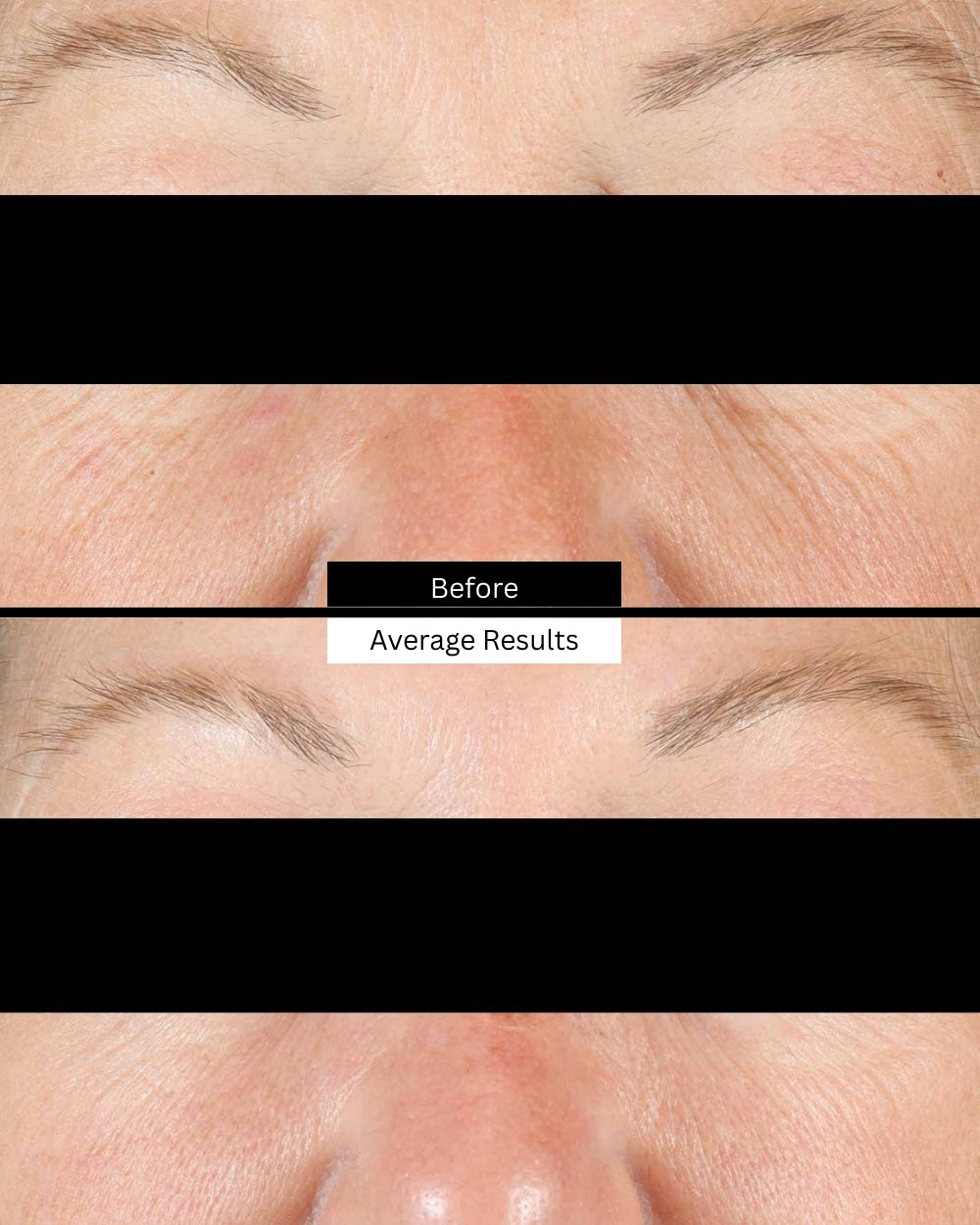 age-interrupter-cream-before-after