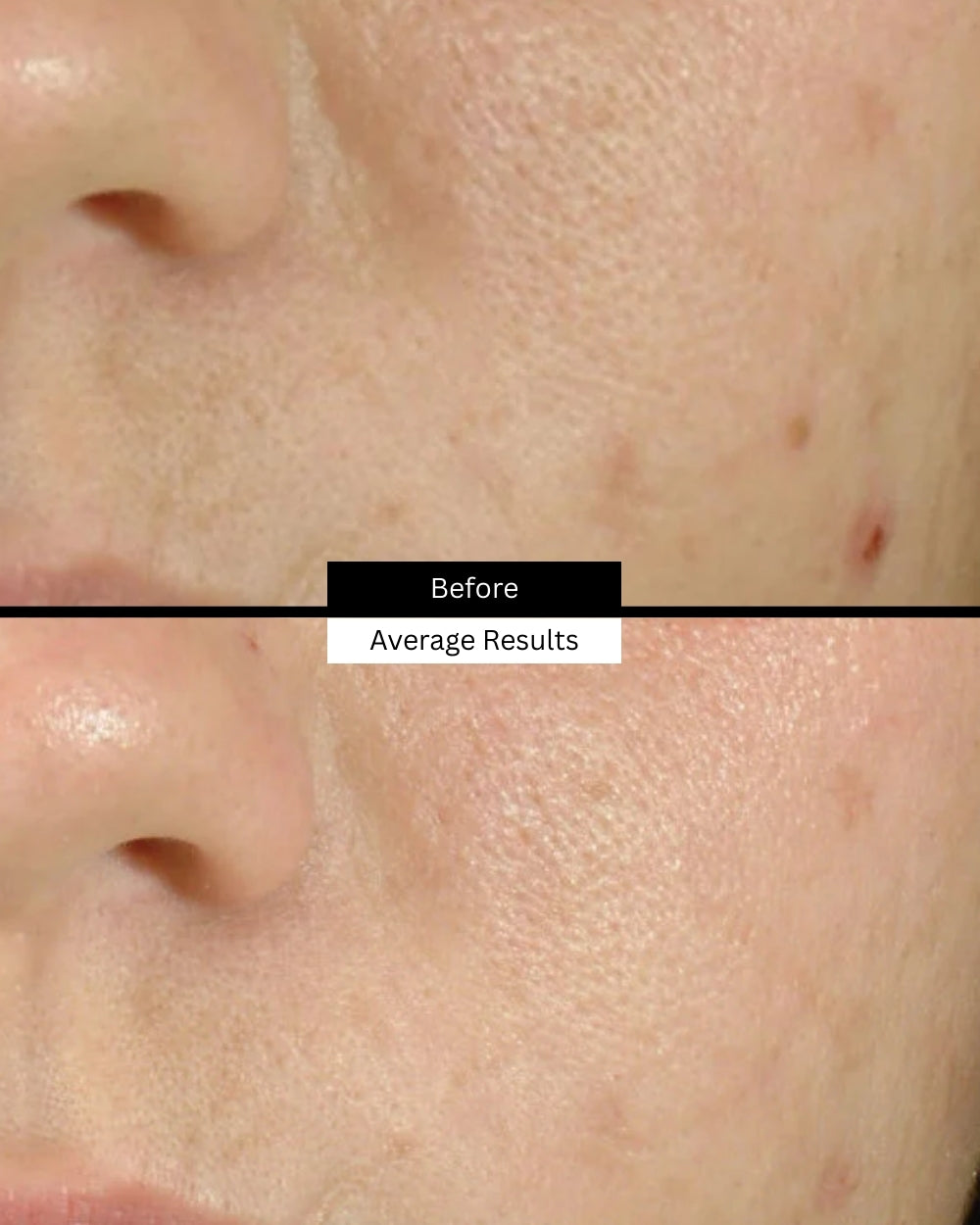 blemish-age-before-after