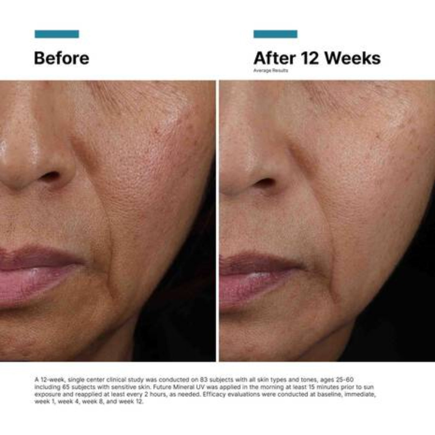 broad-spectrum-sunscreen-with-an-spf-of-30-or-higher_2
