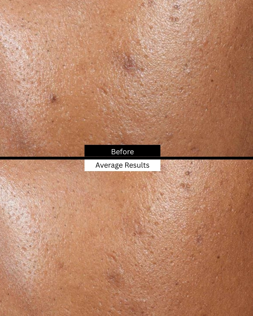 phyto-a-before-after