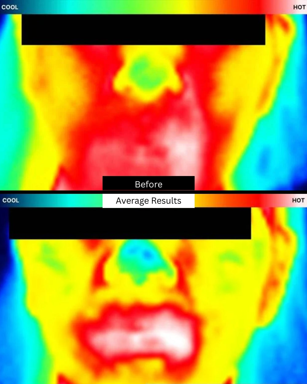 phyto-corrective-gel-before-after
