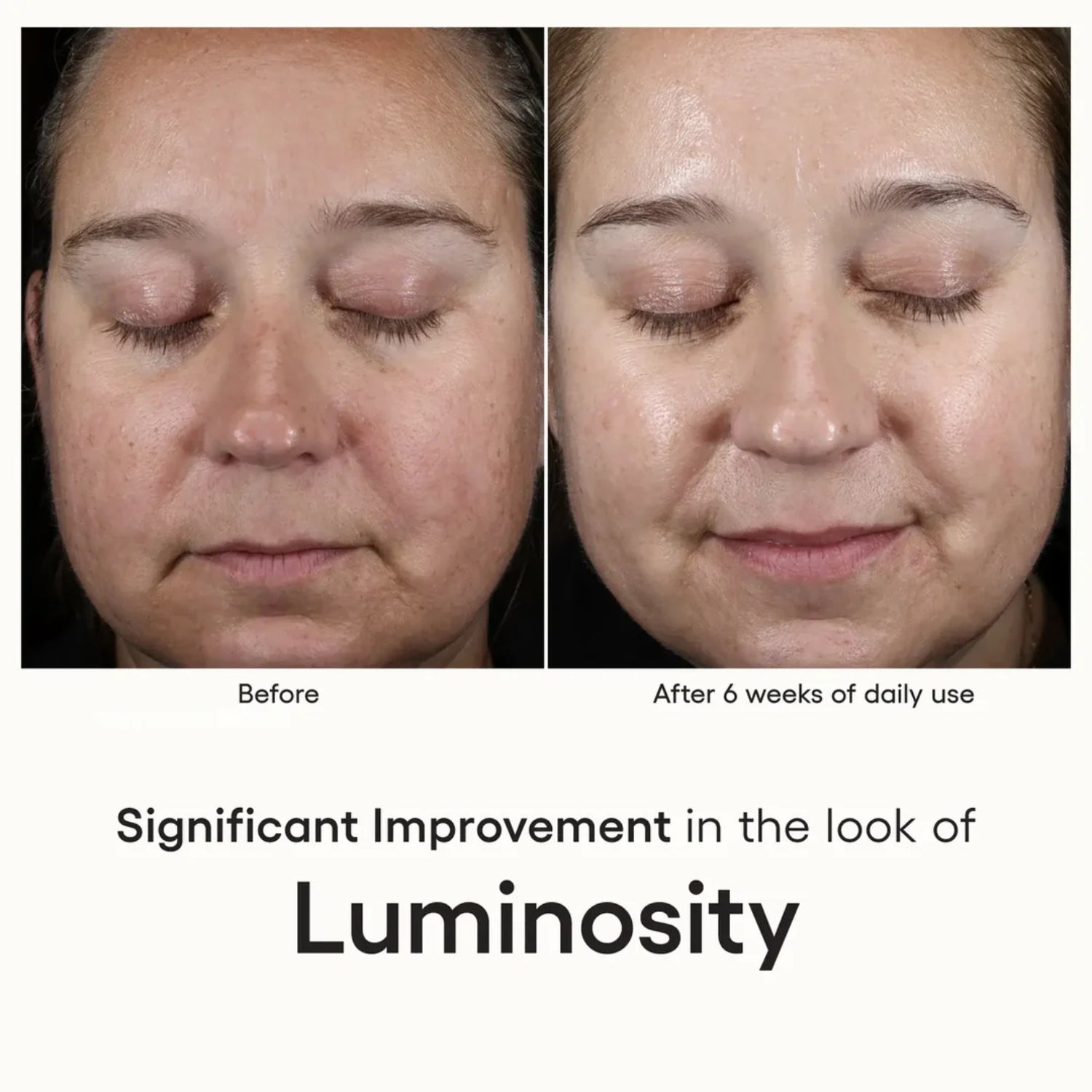 Plated Intense Exosomes – Advanced Serum for Skin Repair