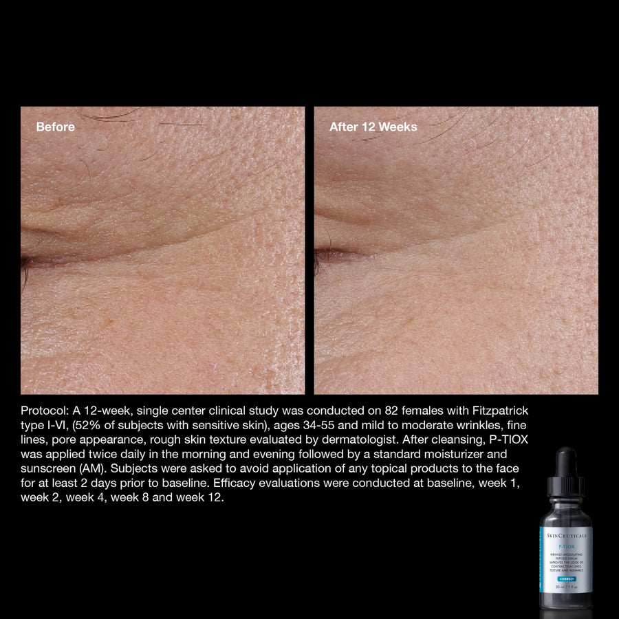 post-botox-instructions