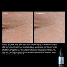 post-botox-instructions