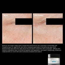 skinceuticals-age-eye-complex